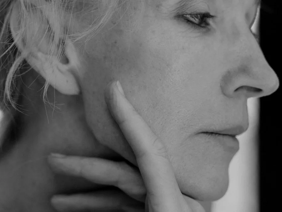 Facelifting